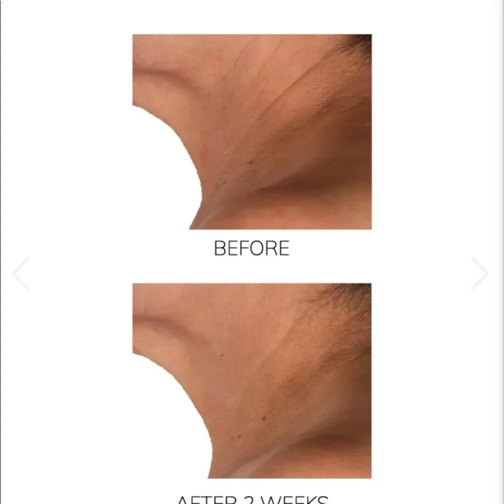 DIAMOND CONTOUR LIFTING ROSE QUARTZ NECK SERUM Firming Treatment + Youth…